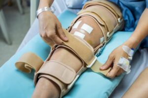 Post-Surgery Recovery The Critical Role of Lymphatic Drainage - manual lymphatic drainage new orleans -nola stretch